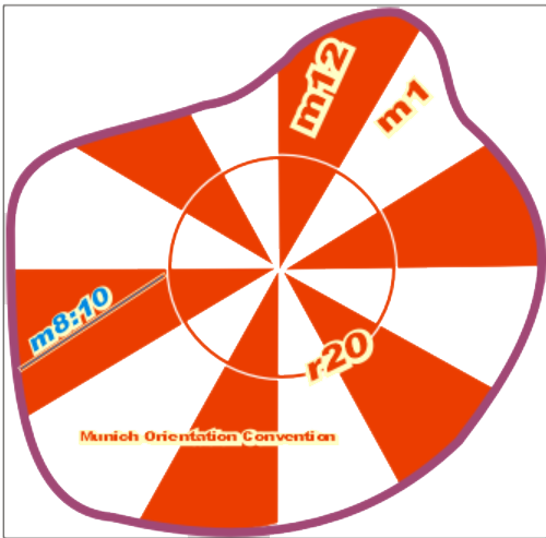 eb